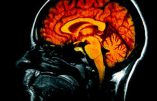 Cerveau : découverte du centre de la conscience