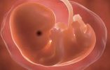 Les conséquences pratiques de la révocation de Roe contre Wade: le planning (anti-) familial a déjà cessé de commettre des avortements dans 9 Etats